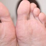 両足のドアップ足裏その２